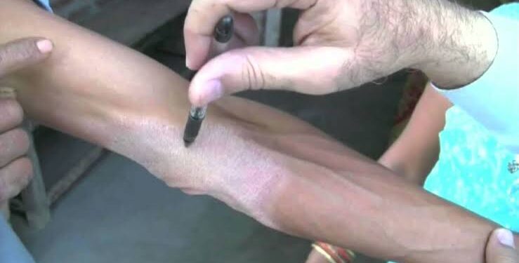 Leprosy and tuberculosis search drive