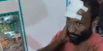 Pedestrians were hit by a bus