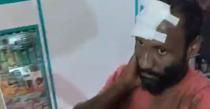 Pedestrians were hit by a bus