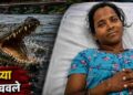 Daughter saves mother from crocodile's jaws